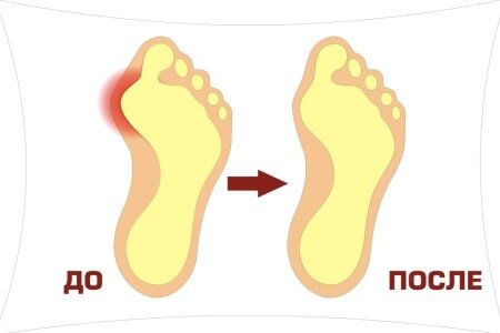 до и после